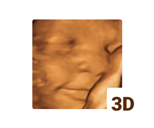 3d ultrasound gilbert